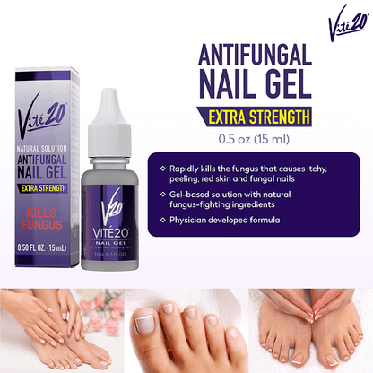Vite20 - Anti-Fungal Solution - Gel .5oz